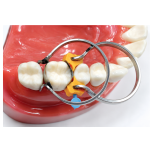 Dental Sectional Matrices with 2 rings Kit SC0103 - Image 3